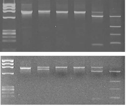 Figure  4.  Restriction  pattern  of  the  PCR  product  that  amplified  by  Ts-B  and  Ts-R  primer  set