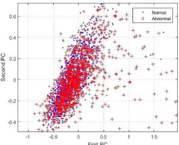 Fig.  12.  Normal  and  abnormal  data  sounds  using  their  time  series  based  statistical  features.