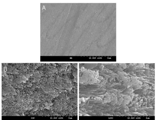 Fig. 1.  Morphology of enamel surface after bleaching with 35% cabamide peroxide; A: non bleached, B: 35% cabamide peroxide+no light, C: 35% cabamide peroxide+Plasma arc (×10,000).