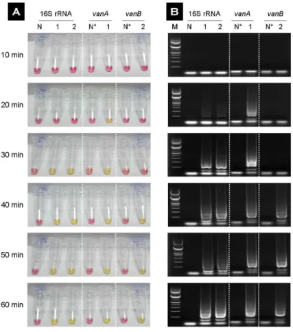 Fig. 2.  Visual  (A)  and  agarose  gel  (B)  images  of  the 16S rRNA, vanA, vanB loop-mediated isother-  mal amplification (LAMP) product of  vancomycin-  resistant  Enterococci  (VRE)  on  various  reaction  times
