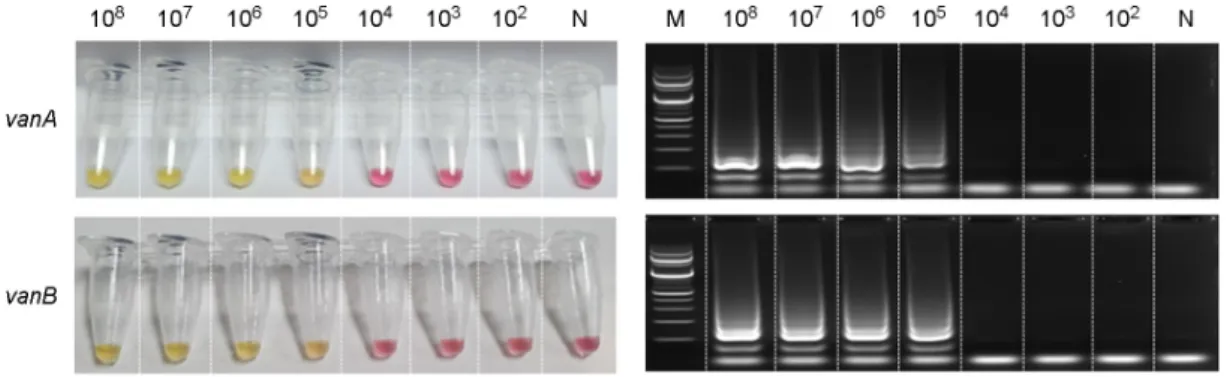Table 3. The results of loop-mediated isothermal amplification method for the detection of vanA, vanB and 16s rRNA gene from 140 strains 