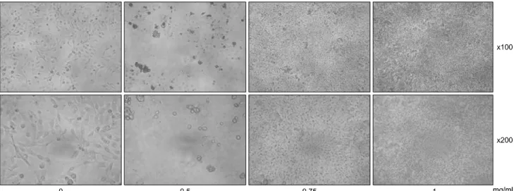 Fig.  1.  Morphology  changes  of  human  oral  cancer  YD-10B  cells  by  -gluconsan  calcium.