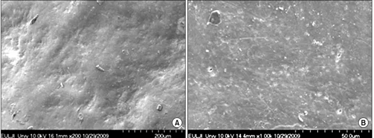 Fig.  1.  Scanning  electron  micrograph  of  sound  enamel  surface  (A,  200×;  B,  1,000×).
