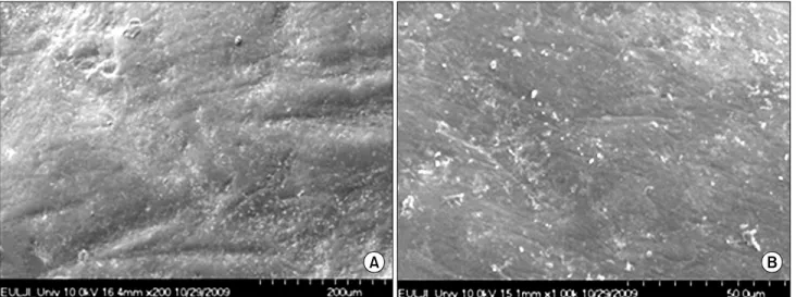 Fig.  2.  Scanning  electron  micrograph  of  sound  enamel  surface  treated  with  fluoride  varnish  (A,  200×;  B,  1,000×).