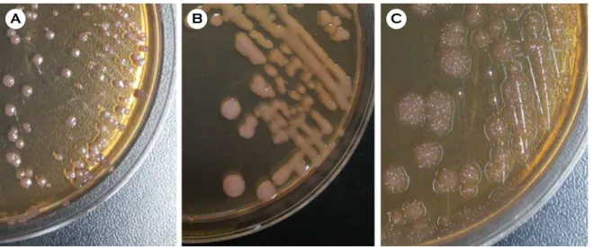 Fig. 2 shows the PCR amplification results for the rpoB  gene. One-hundred and twenty three Acinetobacter clinical  isolates  were  analyzed  using  the  rpoB  gene  genotyping  (Supplementary data 1)