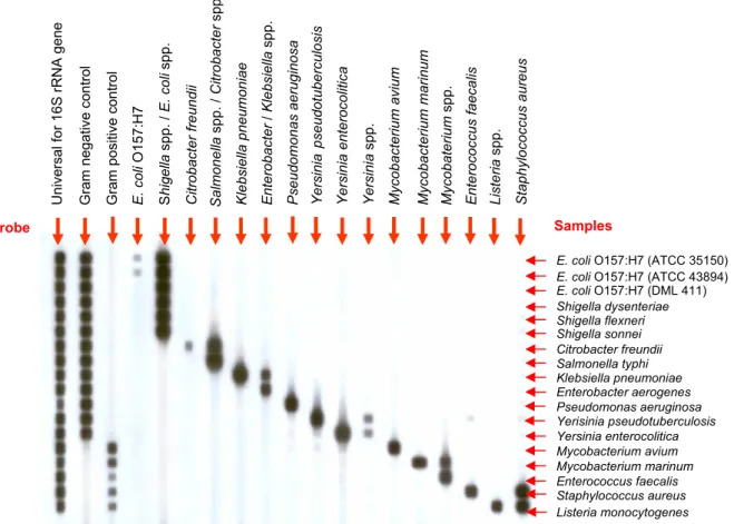 Fig. 1. The specificity of  the PCR-REBA. PCR amplicons obtained from amplification of the reference strains of bacterial DNA were  hybridized to the membrane