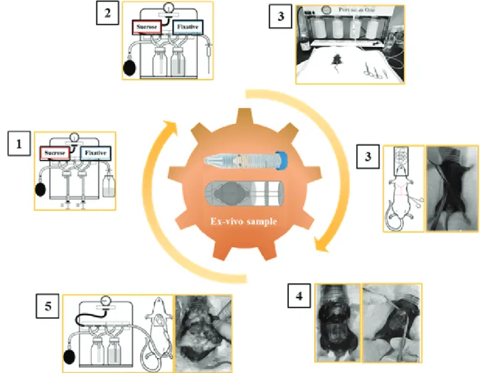 Fig.  1.  The  brain  extraction  procedure.