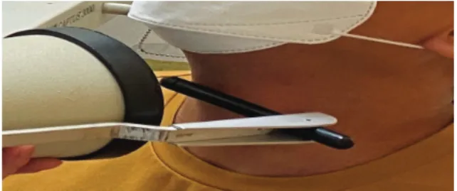 Fig.  2.  99m TcO 4 -   is  placed  in  a  syringe  and  measured  for  1  minute  using  a  thyroid  uptaker.