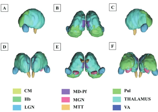 Fig.  1.  3D  models  of  segmentations:  left  lateral  (A),  superior  (B),  right  lateral  (C),  anterior  (D),  inferior  (E),  and  posterior  (F)
