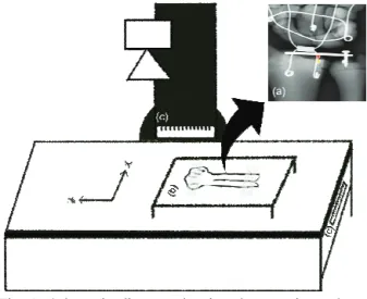 Fig.  1.  Schematic  diagram  showing  the  experimental  meth od  (a)  a  ph antom  radiograph   with   a  triangular  lead  piece  on  the  radial  bone  phantom  and  a  square  lead  piece  on  the  ulna  bone  phantom  (b)  image  of  wrist  phantom  