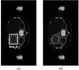 Fig.  1.  MASH  phantom  images  by  using  MATLAB  software:  (a)  original  image  and  (b)  noisy  image.