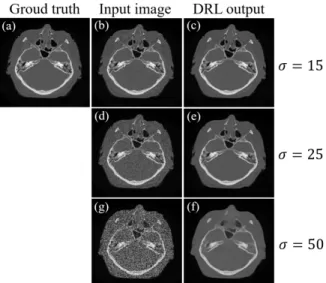 Fig.  6.  (a)  Ground  truth  head  CT  image.  (b),  (d)  and  (g)  are  the  input  head  CT  images  including  the  Gaussian  noise  with  the  standard  deviations  of  15,  25  and  50,  respectively
