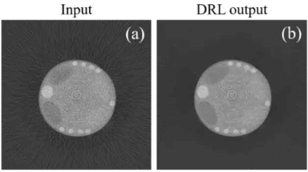 Fig.  10.  (a)  Input  image  obtained  by  using  the  prototype  micro  CT  system  and  cylindrical  phantom 