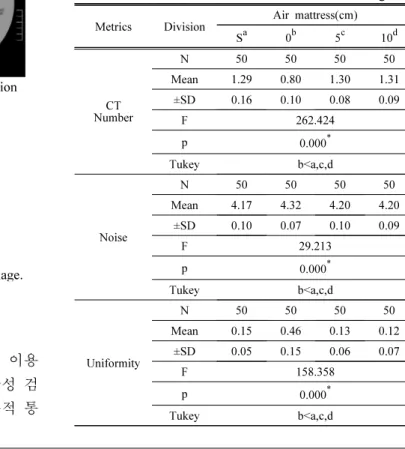 Table  1.  Evaluation  of  AAPM  Phantom  CT  image Metrics Division Air  mattress(cm)