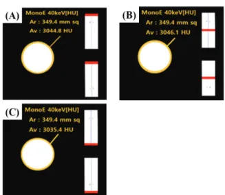Fig. 2. Measurement Data at dilution ratio 8:2 and 40  keV, first slice (A) and 28th slice (B) and 56th slice  (C)
