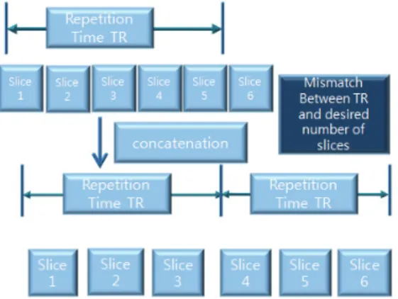 Fig. 3. Schematic diagram of three-segmented concatenation TR