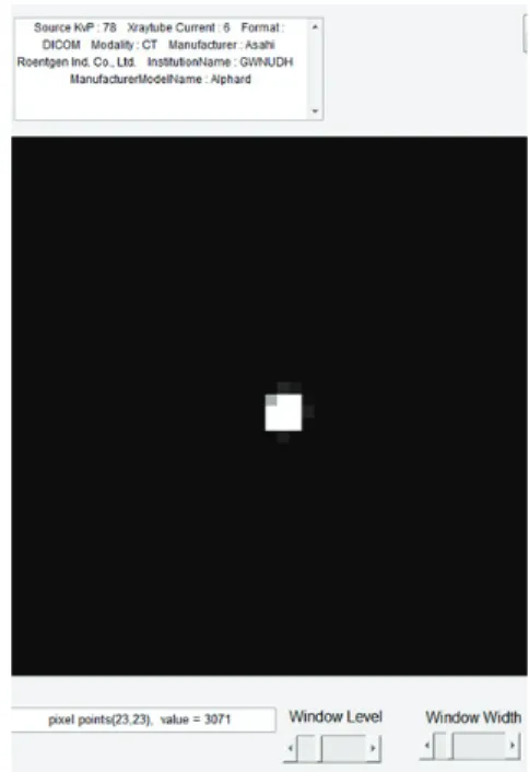 Fig. 3. The steps of magnification and image  adjustment were performed for a setting of a  wire center from the PSF phantom image.