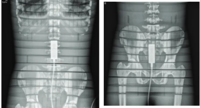 Table 1. X-ray beam quality related digital radiography  was analyzed according to PAE and HVL.