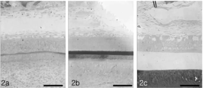 Fig. 2. a: Photomicrograph of control presecretory zone stained by modified multiple stain