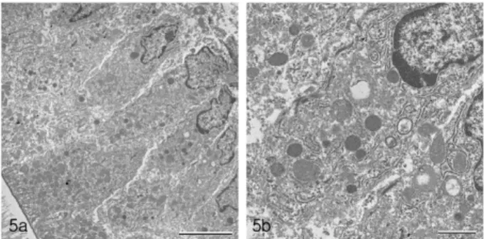 Fig. 5. Transmission electron micrographs of ameloblasts in control maturation zone. a: Low magnification of ameloblasts.