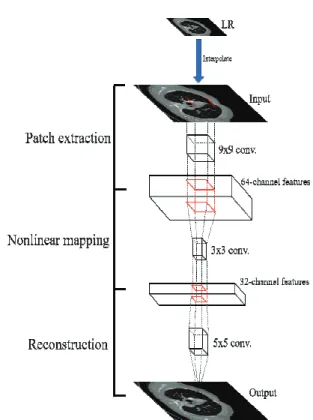 Fig. 1. Architecture of the SRCNN.