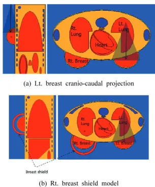 Fig. 2. Simulation model for dose assessment during  Lt. breast cranio-caudal(CC) examination.
