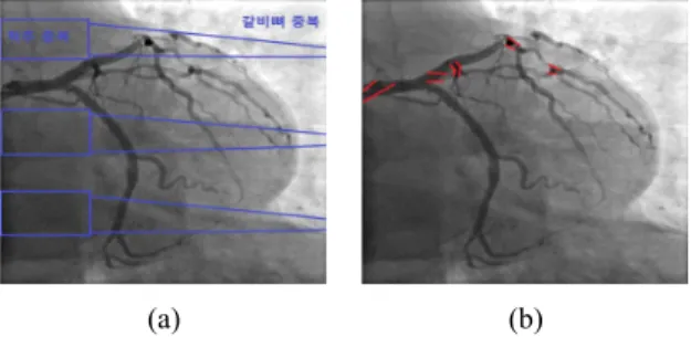 Fig.  8.  Overlap  section  on  left  coronary  artery  of  spine,  rib  (a)  and  small  vessel  (b).