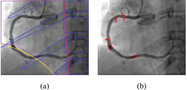 Fig.  13.  Overlap  section  on  right  coronary  artery  of  spine,  rib,  aorta,  liver  (a)  and  small  vessel  (b).