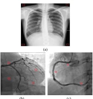 Fig.  15.  Background  of  chest  PA  (a)  and  LCA  view  (b)  and  RCA  view  (c)  of  CAG.