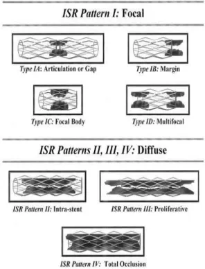 Fig.  1.  Patterns  of  in-stent  restenosis  by  Mehran’s  classification.  ISR:In-stent  restenosis.