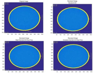 Fig.  1.  Variation  of  Image  Quality  of  Phantom  Image  by  the  Denoising  Methods.