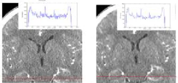 Fig.  5.  Scout  image  obtained  by  checking  the  possibility  of  experiment.
