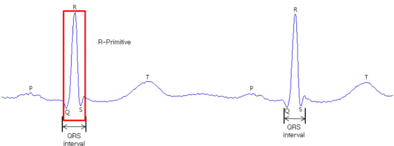 Fig. 3. Candidates of R-peak of MIT-BIH ADB 103m record.