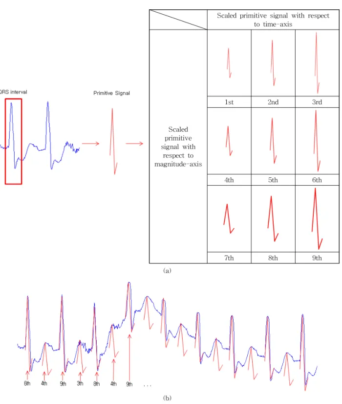 Fig. 6. MRA for R-peak Detection. (a) Scaled primitive signals of MIT-BIH ADB 109 record, (b) Similarity calculation  for MIT-BIH ADB 109m record.