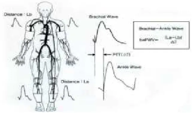 Fig.  1.  Model  diagram  of  baPWV.