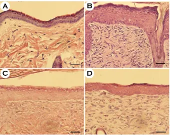 Fig. 4. Microscopic comparison of DNCB-treated Sprague- Sprague-Dawley rats applied with mixture of  C