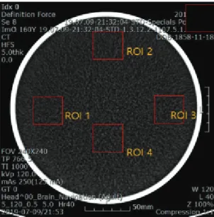 Fig. 2. Dose report of CTDI, DLP for dose  assessment.