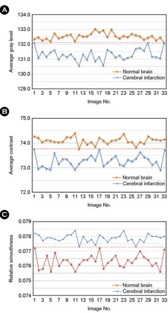 Fig. 1. Texture feature analysis for normal and cerebral infarc- infarc-tion in computed tomography (CT) images