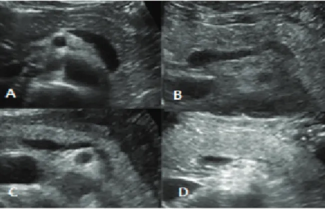 Fig. 1 은  정상과  지방췌장의  초음파  영상을  나타 내었다.
