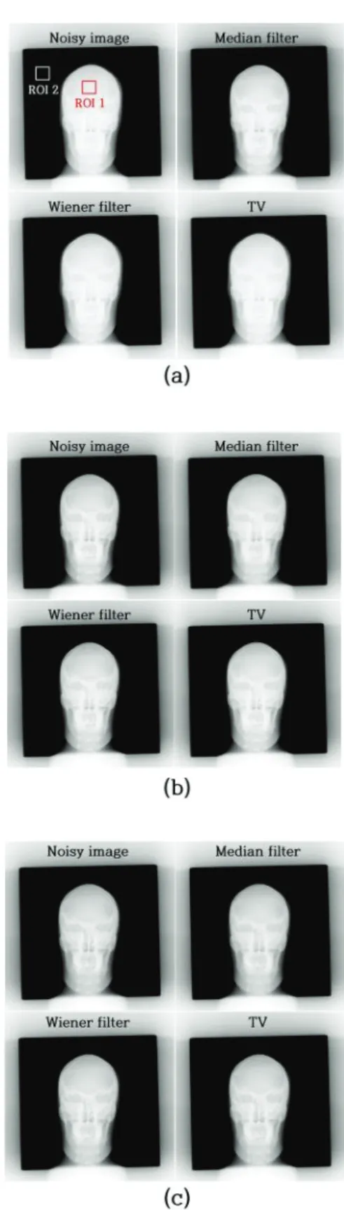Fig. 2. Result images for including various noise  reduction algorithms at fixed 12.5 mAs using (a) 65,  (b) 75, and (c) 90 kVp.