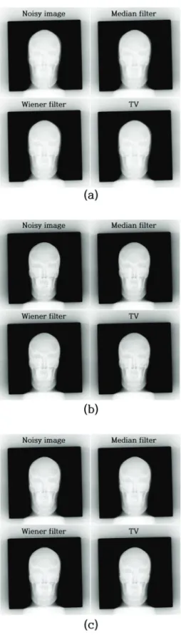 Fig. 3. Result images for including various noise  reduction algorithms at fixed 74 kVp using (a) 8, (b)  16, and (c) 32 mAs.