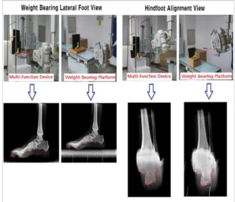 Table  1.  Comparison  of  resolutions  of  the  weight-bearing  lateral  foot  image.