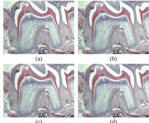 Fig.  2.  Example  light  microscopic  image  using  mouse  tooth  including  ROIs  for  calculation  of  contrast  to  noise  ratio  (ROI  A  and  B)  and  coefficient  of  variation  (ROI  A).