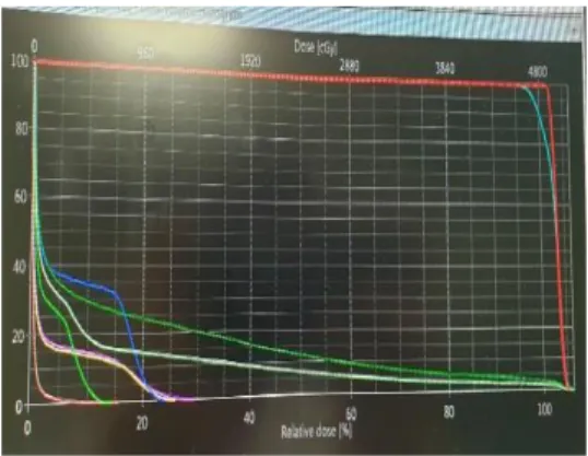 Fig.  7.  Dose  distributions  of  four-dimensional  treatment  plans  lung  cancer.