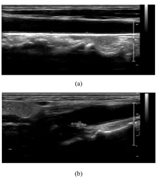Fig.  2.  Carotid  artery  IMT(a)  and  atherosclerotic(b)  measurement.