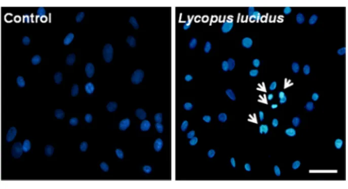 Fig. 1. Effect of  Lycopus lucidus Turcz extract on proliferation  of MCF-7 cells. Cells were treated with methanol extract of  Lycopus lucidus Turcz in various time and concentration