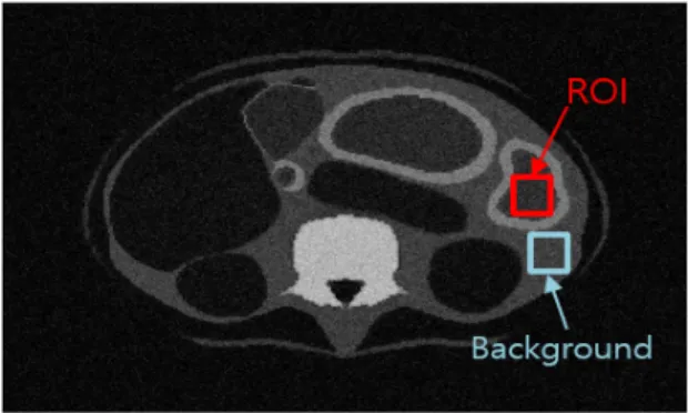 Fig.  1.  ROI  set-up  in  abdominal  Image  based  on  MASH  phantom. 