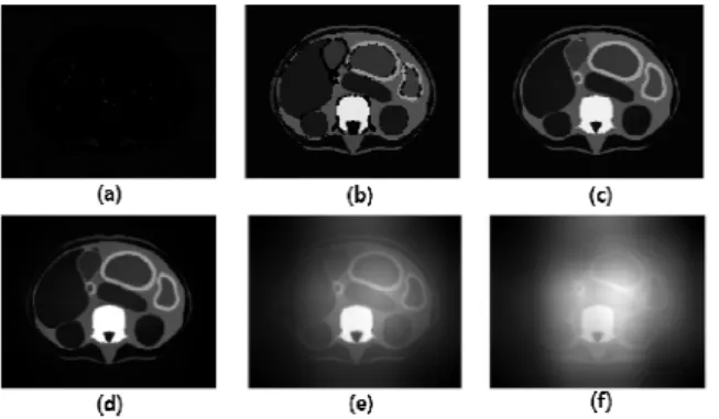 Fig.  2.  Images  of  the  application  with  the  FNLM  noise  reduction  algorithm  by  changing  filtering  factor: 