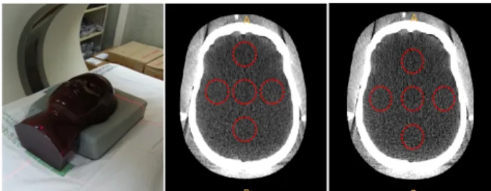 Fig.  3과  같이  Bone  알고리즘으로  변화  적용하여  영상을 재구성(Reconstruction)  후  동일한 크기의 관심 영역(ROI)을  설정  후  현재  임상에서  가장  많이  적용 하고 있는 기준영상과의 평균 CT  Value와 Pixel  Value 를  측정하여  화질이  가장  유사하면서  선량을  감소시 킬  수  있는  스캔조건과  알고리즘을  찾아보았다.