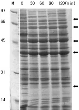Fig. 5. Protein display using SDS-PAGE Gel Electrophoresis.